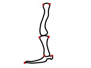 Fig 3 Typothorax with points