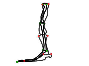 Fig 5 Superimposition of the two legs